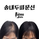 주식회사 스카이뷰 | 송내두피문신 모발이식과 두피문신을 고민하는분 보세요 전부 알려드리겠습니다.