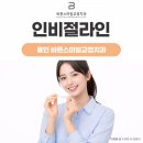 바른스마일치과교정과치과의원 | 구성동치과, 인비절라인이 일반 교정과 다른 점은?