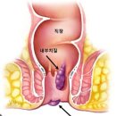 제주대항외과 네이버블로그