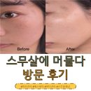 아산배방중학교 | 1:1 맞춤 케어 아산 피부관리 후기