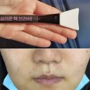 광민약국 | 피부착색연고 대체 가능한 크림