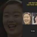 성형 한방으로 인생 역전한 연예인 이미지