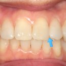 나무 기공소 이미지