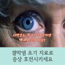 눈시원안과의원 이미지