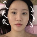 에이치더뷰티# | 구로 경락 추천 에이치앤뷰티 내돈내산 후기｜비대칭 얼굴 교정 3D 윤곽케어 효과