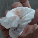 난초꽃피다임앤오안과의원 | 임신23주차~25주차 임산부 눈병 결막염 각막염 대구시지 난초꽃피다임앤오안과