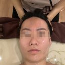 다산신부관리 미올뷰티 올모드(3V+하이푸리프팅+물방울리프팅) 후기
