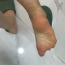 뚜레쥬르세종첫 - 25050 | 부산 해운대 장산역 패디플래닝 여름대비 발각질관리 슈가윤뷰티