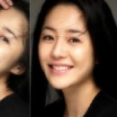 피부미인 Daum카페