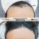 제이비라인 이미지