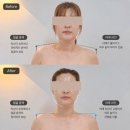 신동 금호어울림 | 익산 정든 네일 &amp; 에스테틱 윤곽관리 3V 테라피 후기