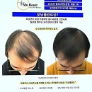 리체프라자 | 찐텐으로 머릿결 구세주 영접 후기!!