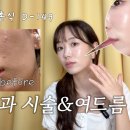 나솔 보는 여시? 30기 옥순님 피부과 시술 &amp; 여드름 교정 후기 보고가 이미지