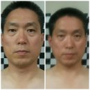 웰빙피부관리실 네이버블로그