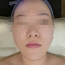 스킨라이프 | 용인피부관리샵으로 골드스킨라이프 찐 후기, 역북동 에스테틱 피부관리 후기