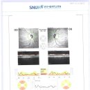 OCT와 시야검사 차트 올립니다 이미지