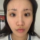 (주)코만 3공장 | [청담스킨부스터] 안아픈 스킨부스터 (연예인들이 다니는 청담피부과 플렉스 후기+ 엠보 다운타임)
