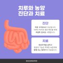 치루개 이미지