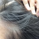 세보마트 | [솔직후기] 비듬, 각질, 기름짐 고민에는 지루성두피 전용샴푸인＜볼빅 세보샴푸＞추천!