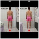 더나은 | 일산체형교정 더나은체형교정원 후기