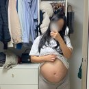 SST | 복부 백반증 후기 SST 수술 치료 비용 후기 그리고 임신