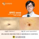 봉봉성형외과의원 | 성형후기_어디서 봐야 하죠?