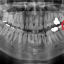 나우치과의원 이미지
