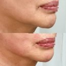 (주)탑스코리아 | 청라 피부관리 추천 7년째 다닌 내돈내산 에스테틱 탑스뷰티 후기