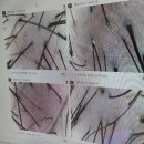 반석프라자 사거리(2) | 대전 반석점 헤드스파K 두피케어 관리후기 2주차