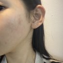 김혜영피부과의원 | 해운대 서울피부과 후기