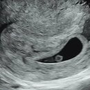 조혜진여성의원 이미지