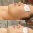 안락동 피부관리 림에스테틱 후기