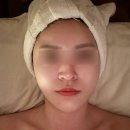 광안리 피부관리 신에스테틱 라콜린 관리 후기