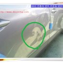 덴트렉스 이미지