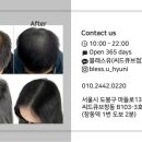 블래스유 이미지
