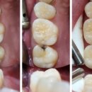 태양치과기공소 이미지