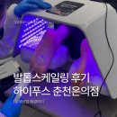 춘천로17번길 | [하이푸스 춘천온의점] 춘천발각질 무좀발톱 스케일링 후기