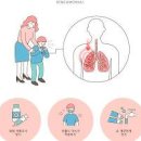 폐렴구균 폐렴 증상 감염 전염 원인 치료 이미지