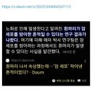 흰머리, 몸이 암을 막은 흔적일수도 있다.↓ 이미지