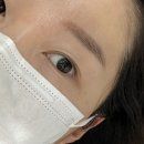 다나약국 | 창원 눈썹문신제거 다나브로우