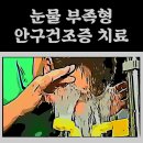 [내돈내산] 강남 스마일라식 Q&A / 스마일라식 후기(4달) /ㅈㅇㅅ안과 할인방법