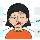 안면하우스 이미지