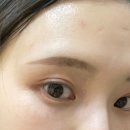 스누성형외과의원 이미지