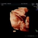 서울메디의원 | 입체초음파 저렴한곳 평택 서울유산부인과의원 후기!