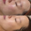 비나인에스테틱 이미지