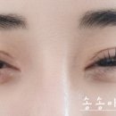 송송아이래쉬 이미지