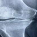 영통원탑정형외과의원 이미지