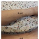 왁싱현 | [동탄왁싱]동탄왁싱잘하는곳 능동 왁싱현 동탄점 팔하프왁싱 후기