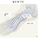 아치날 이미지