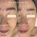 사하구-60 이미지